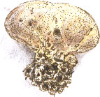 Scleroderma areolatum